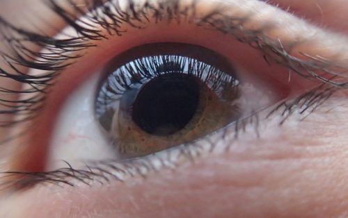 olho | hipermetropia | Clinica Vivina Cabrita